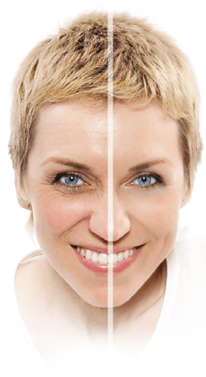 Anti-wrinkle benefits of Kollagen Intensiv ingredients